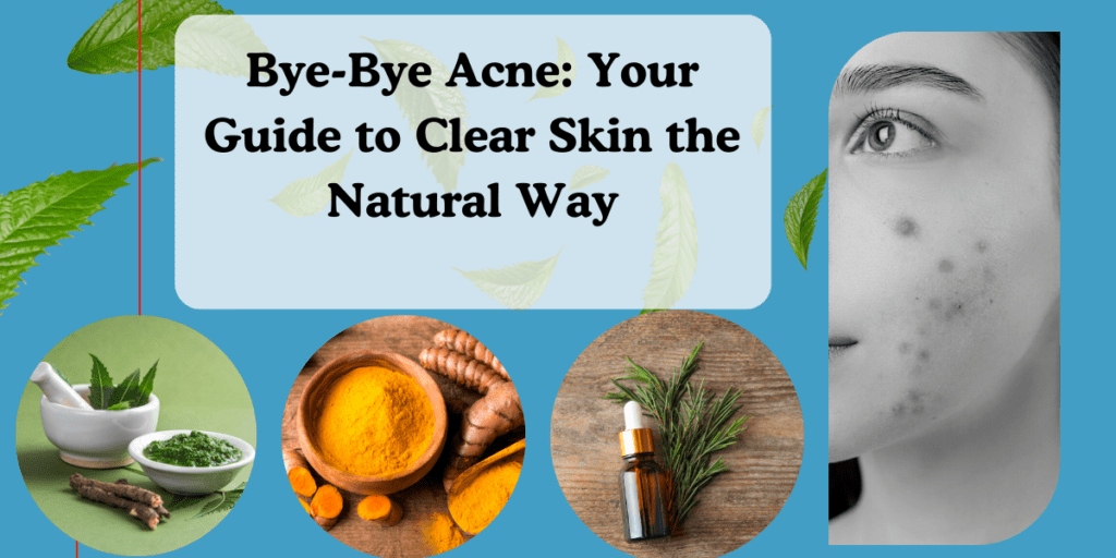 herbal remedies for acne skin