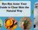 herbal remedies for acne skin