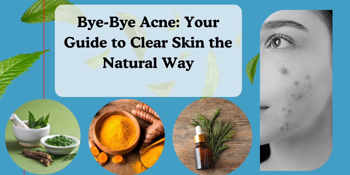herbal remedies for acne skin